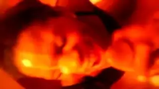 انفجار مزدوج على الوجه: الفم مليء، الشفتين لامعة